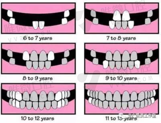 陶瓷牙是假牙和烤瓷牙的区别在哪,这些事需注意(图1)
